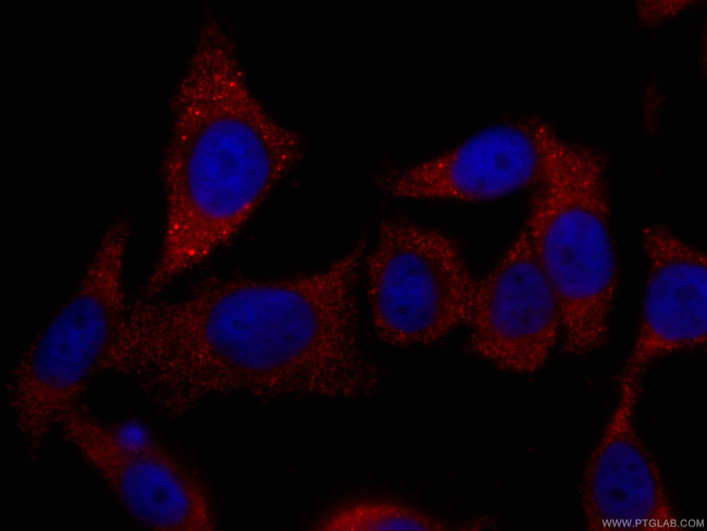 TELO2 Antibody in Immunocytochemistry (ICC/IF)