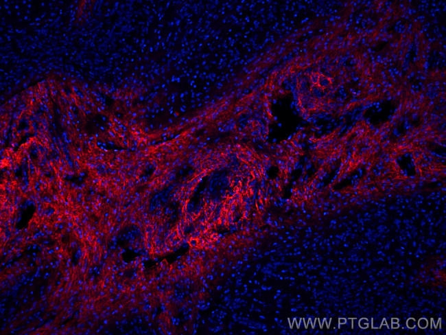 Serum amyloid P component Antibody in Immunohistochemistry (PFA fixed) (IHC (PFA))