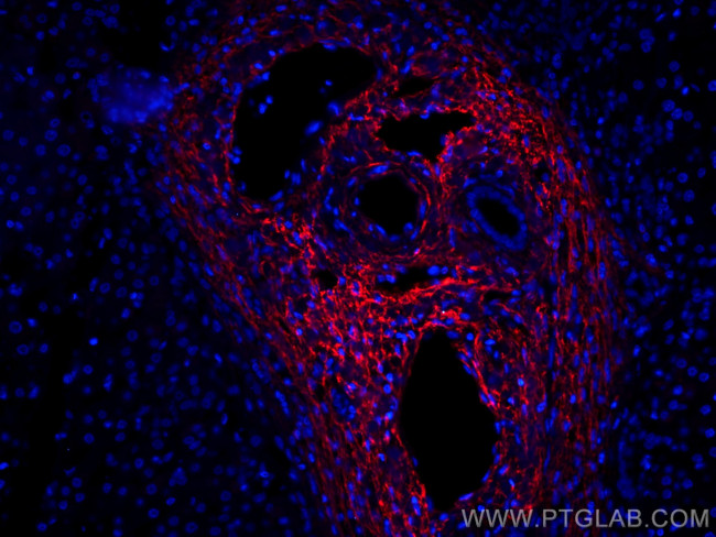 Serum amyloid P component Antibody in Immunohistochemistry (PFA fixed) (IHC (PFA))