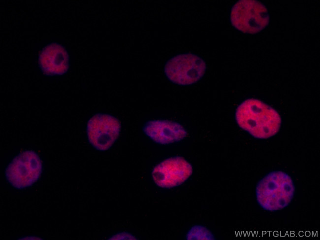 HDAC1 Antibody in Immunocytochemistry (ICC/IF)