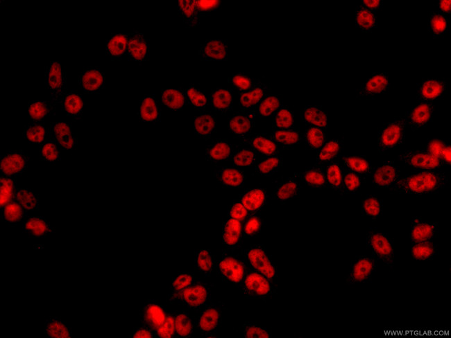 HDAC1 Antibody in Immunocytochemistry (ICC/IF)