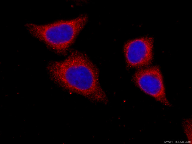 Factor XII Antibody in Immunocytochemistry (ICC/IF)