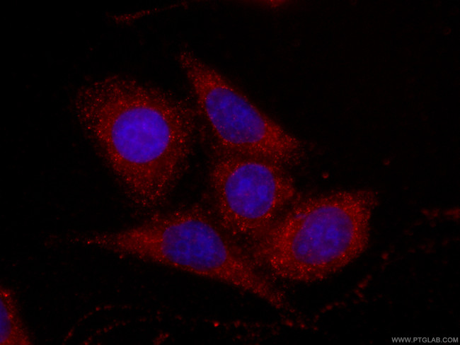 Fetuin-A Antibody in Immunocytochemistry (ICC/IF)