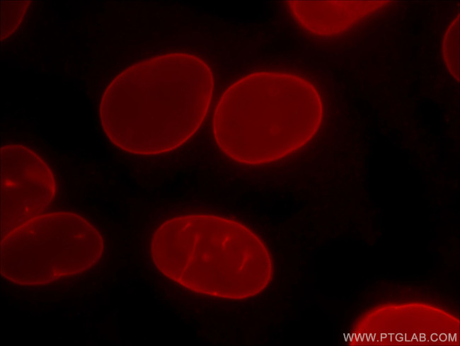 Lamin B1 Antibody in Immunocytochemistry (ICC/IF)