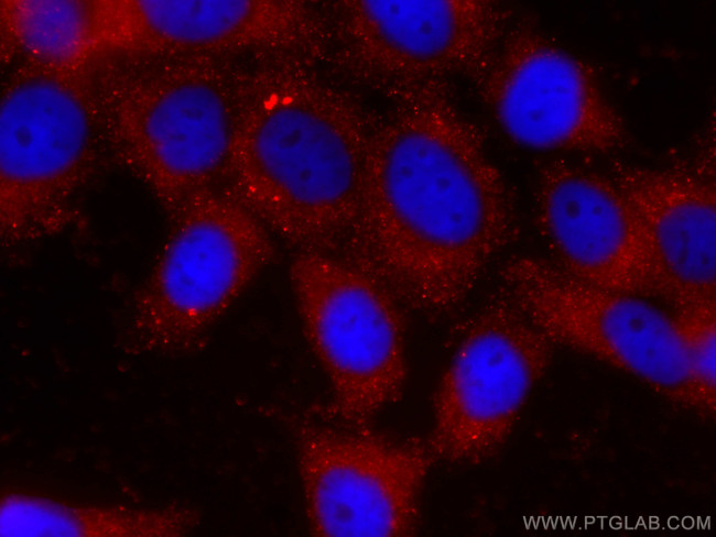 P4HA1 Antibody in Immunocytochemistry (ICC/IF)