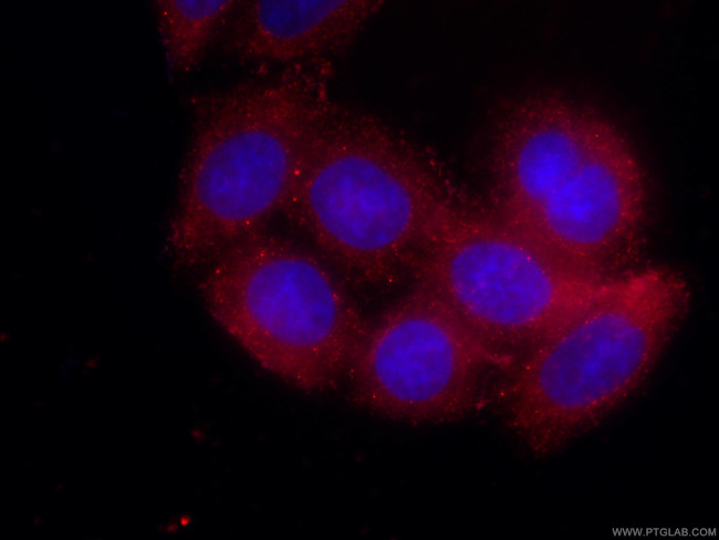 AFM Antibody in Immunocytochemistry (ICC/IF)