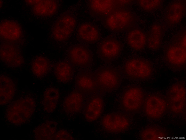 TFIP11 Antibody in Immunocytochemistry (ICC/IF)