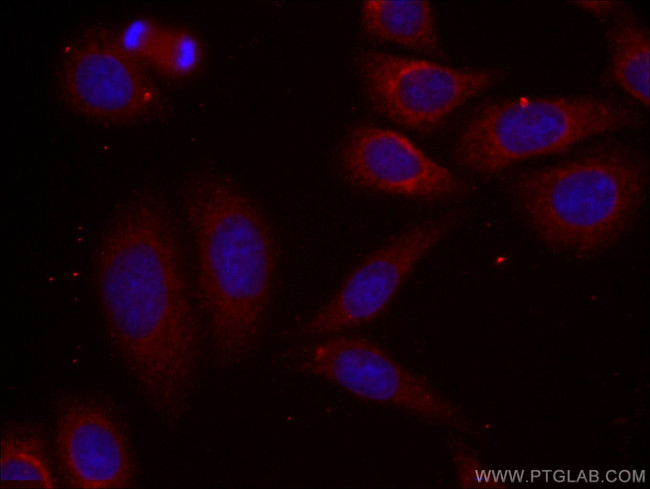 Alpha-2-macroglobulin Antibody in Immunocytochemistry (ICC/IF)