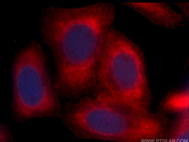 ARG1 Antibody in Immunocytochemistry (ICC/IF)