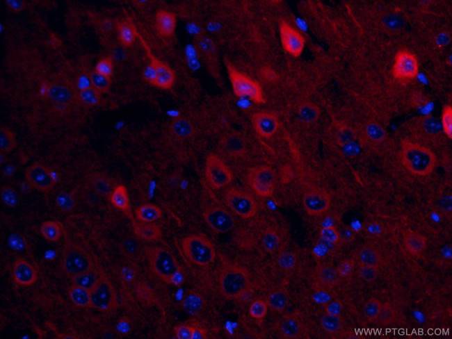 NSE Antibody in Immunohistochemistry (PFA fixed) (IHC (PFA))