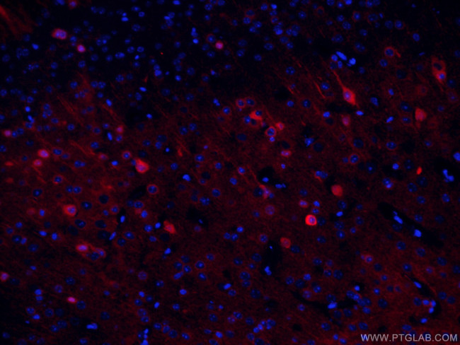 NSE Antibody in Immunohistochemistry (PFA fixed) (IHC (PFA))