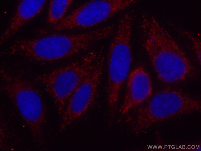 USP13 Antibody in Immunocytochemistry (ICC/IF)