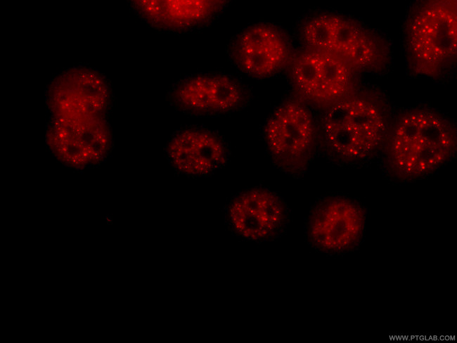 PSMD4 Antibody in Immunocytochemistry (ICC/IF)