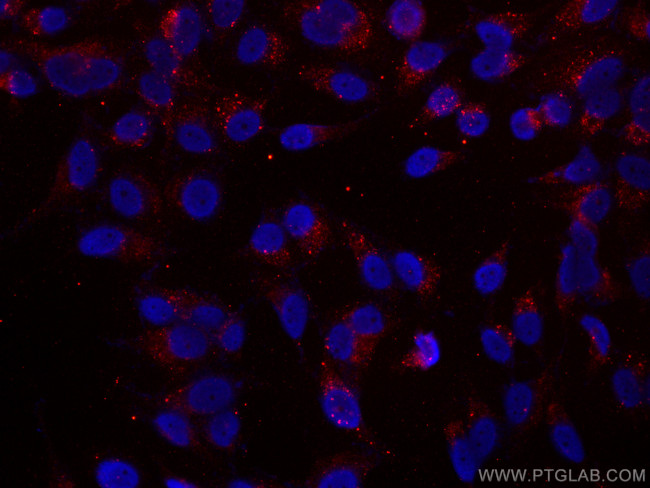 P62/SQSTM1 Antibody in Immunocytochemistry (ICC/IF)