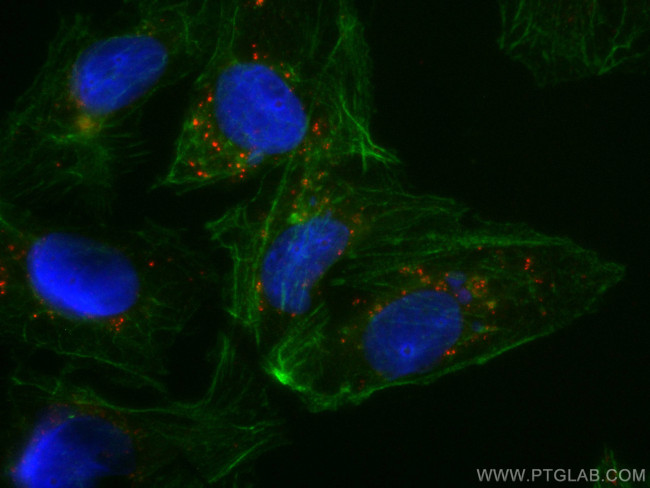 P62/SQSTM1 Antibody in Immunocytochemistry (ICC/IF)