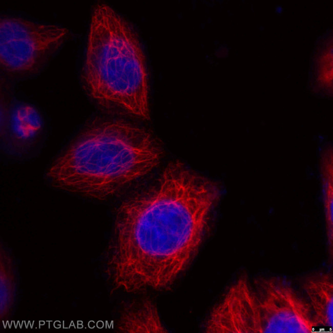 Cytokeratin 18 Antibody in Immunocytochemistry (ICC/IF)