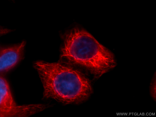 Cytokeratin 18 Antibody in Immunocytochemistry (ICC/IF)