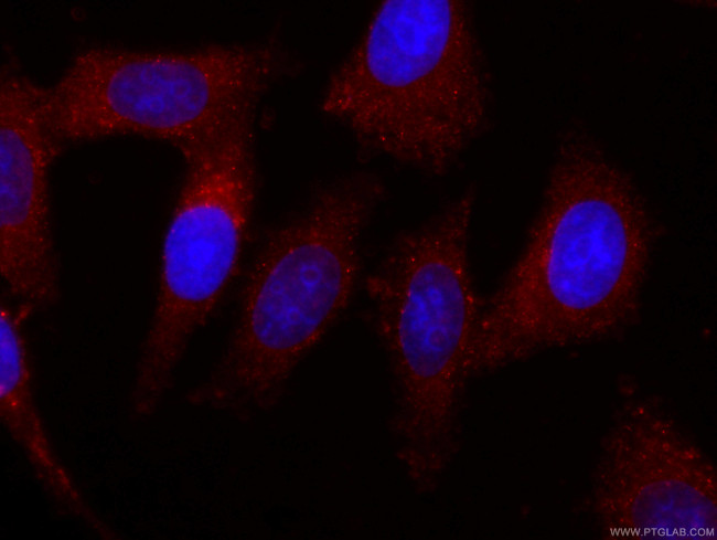 Apolipoprotein AI Antibody in Immunocytochemistry (ICC/IF)