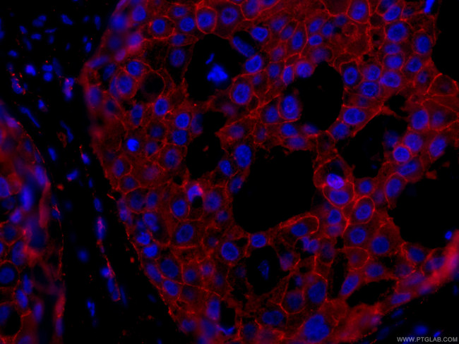 p120 Catenin Antibody in Immunohistochemistry (PFA fixed) (IHC (PFA))