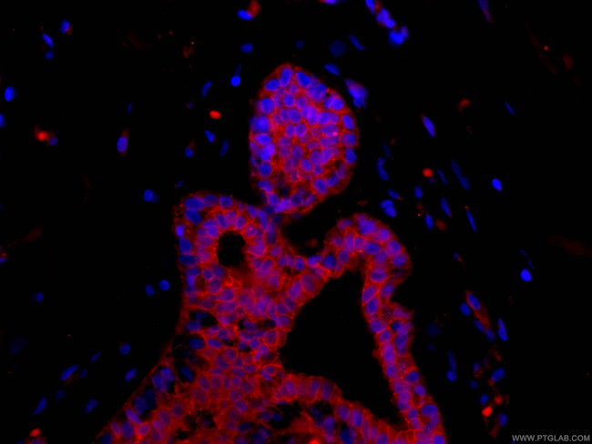 p120 Catenin Antibody in Immunohistochemistry (PFA fixed) (IHC (PFA))