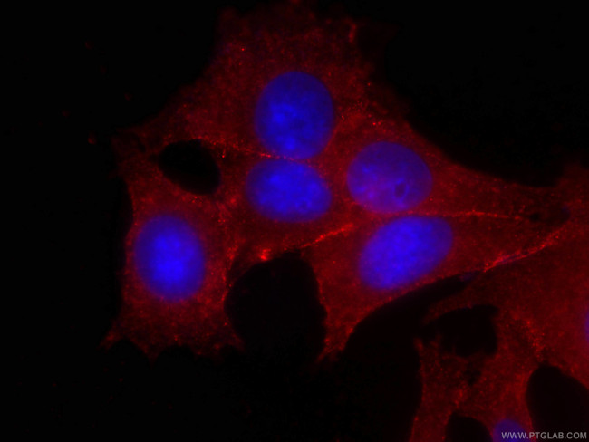 p120 Catenin Antibody in Immunocytochemistry (ICC/IF)