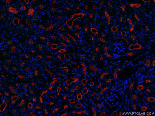 CD13 Antibody in Immunohistochemistry (PFA fixed) (IHC (PFA))