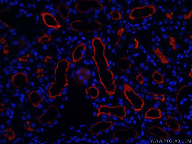 CD13 Antibody in Immunohistochemistry (PFA fixed) (IHC (PFA))