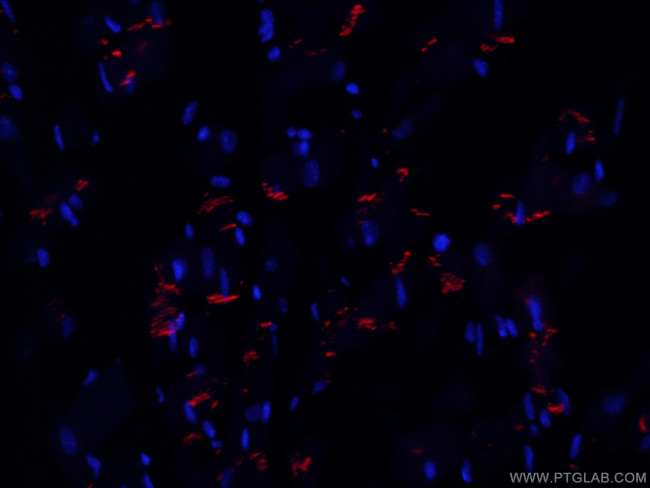 N-cadherin Antibody in Immunohistochemistry (PFA fixed) (IHC (PFA))