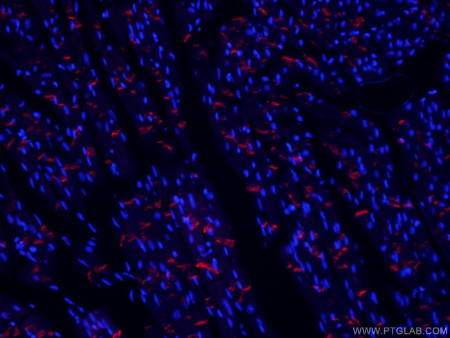 N-cadherin Antibody in Immunohistochemistry (PFA fixed) (IHC (PFA))