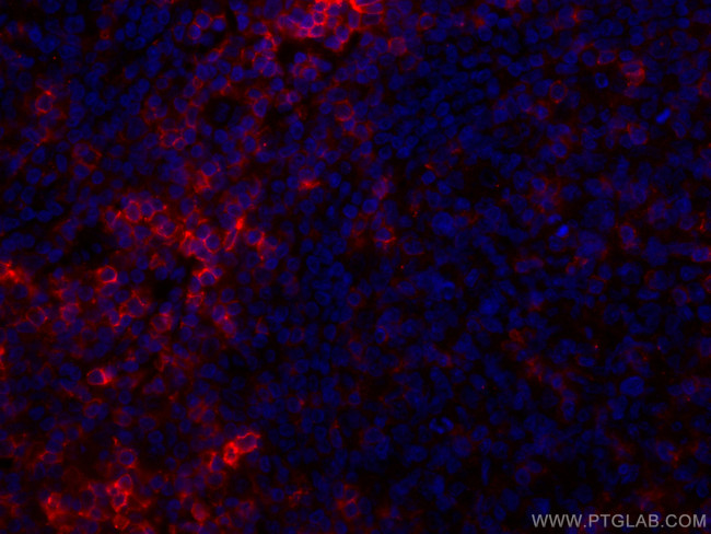 CD43 Antibody in Immunohistochemistry (PFA fixed) (IHC (PFA))