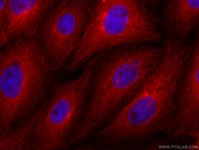 beta Tubulin Antibody in Immunocytochemistry (ICC/IF)