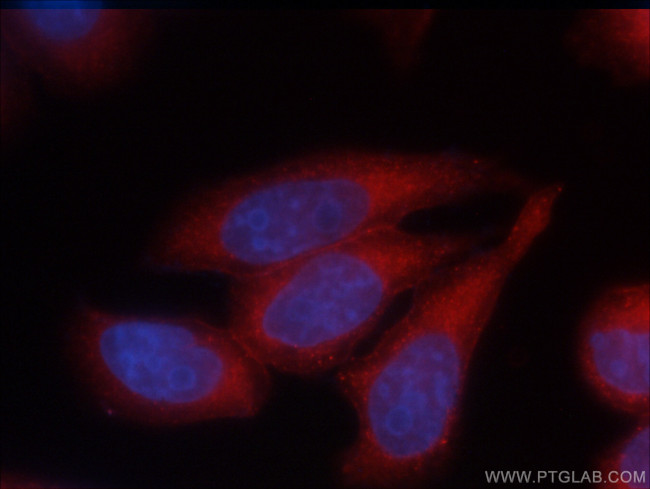 Annexin V Antibody in Immunocytochemistry (ICC/IF)