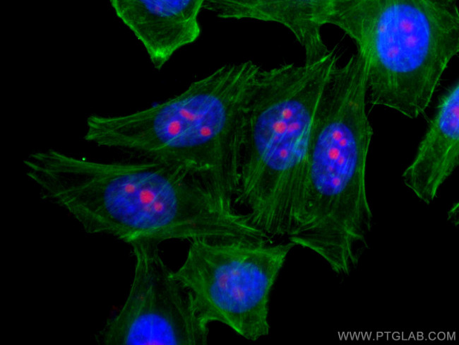 IMP3 Antibody in Immunocytochemistry (ICC/IF)