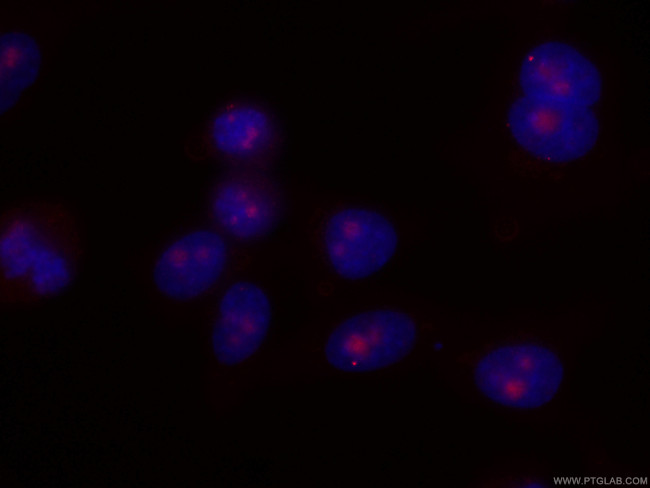 IMP3 Antibody in Immunocytochemistry (ICC/IF)