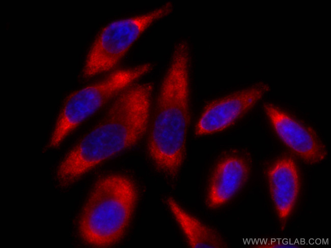 PAI-1 Antibody in Immunocytochemistry (ICC/IF)