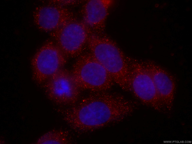 CAPG Antibody in Immunocytochemistry (ICC/IF)