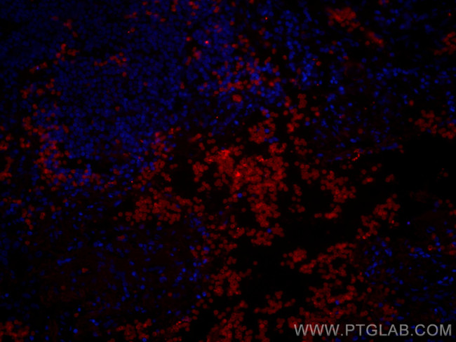 GLUT1 Antibody in Immunohistochemistry (PFA fixed) (IHC (PFA))