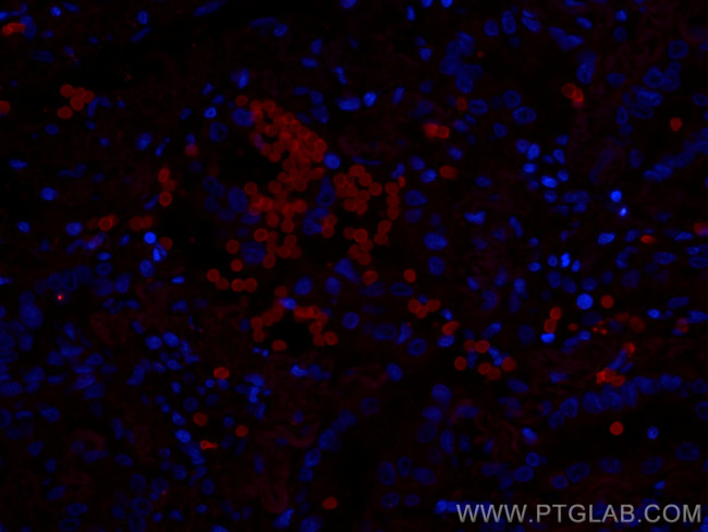 GLUT1 Antibody in Immunohistochemistry (PFA fixed) (IHC (PFA))
