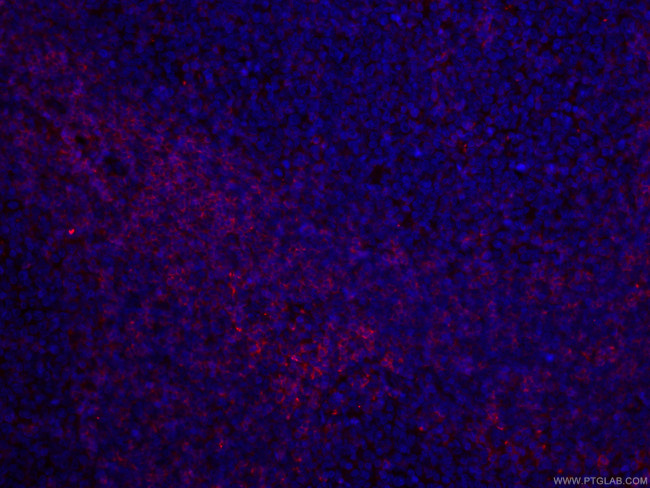 CD27 Antibody in Immunohistochemistry (PFA fixed) (IHC (PFA))