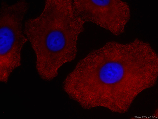 RSPO3 Antibody in Immunocytochemistry (ICC/IF)