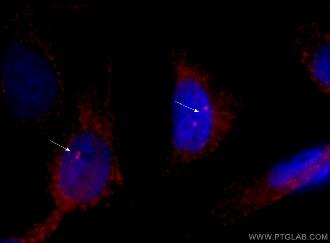 gamma tubulin Antibody in Immunocytochemistry (ICC/IF)