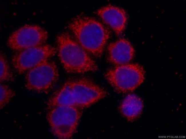 SRD5A1 Antibody in Immunocytochemistry (ICC/IF)