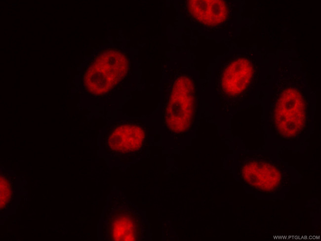 NUDT21 Antibody in Immunocytochemistry (ICC/IF)