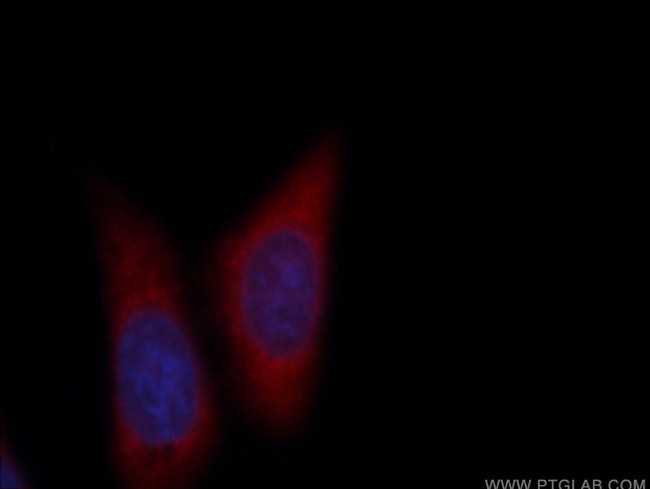 RAB5A Antibody in Immunocytochemistry (ICC/IF)