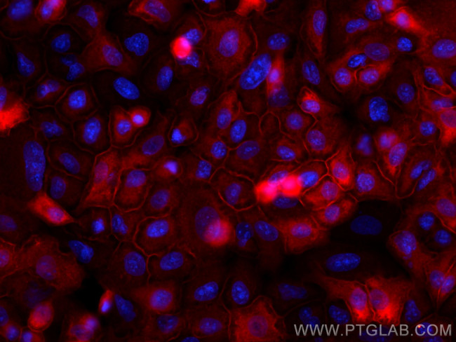 Annexin A1 Antibody in Immunocytochemistry (ICC/IF)