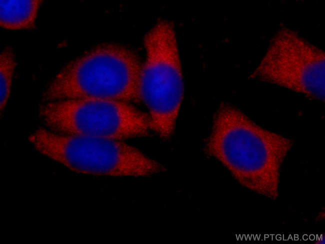 G6PD Antibody in Immunocytochemistry (ICC/IF)