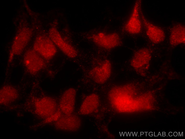 TINP1 Antibody in Immunocytochemistry (ICC/IF)