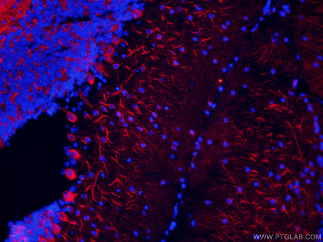 TUBB3-specific Antibody in Immunohistochemistry (PFA fixed) (IHC (PFA))