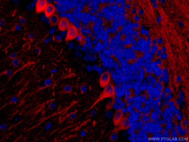 TUBB3-specific Antibody in Immunohistochemistry (PFA fixed) (IHC (PFA))