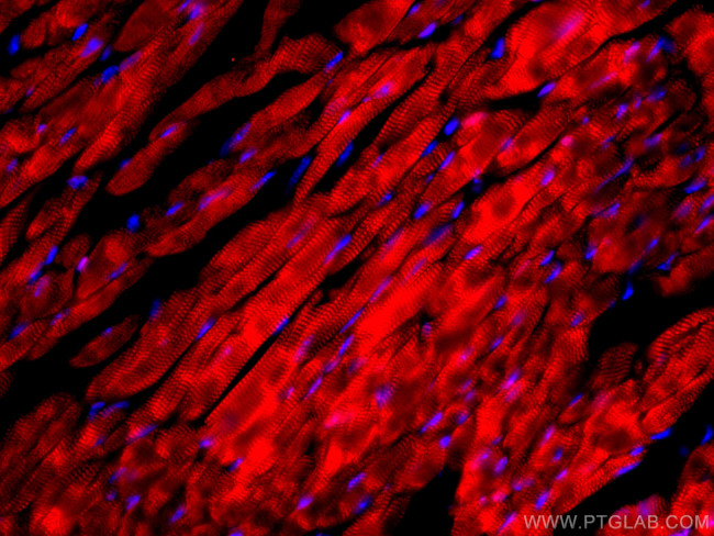 Cardiac Troponin I Antibody in Immunohistochemistry (PFA fixed) (IHC (PFA))